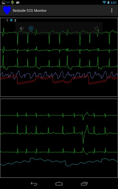 Bedside ECG Monitor截图1