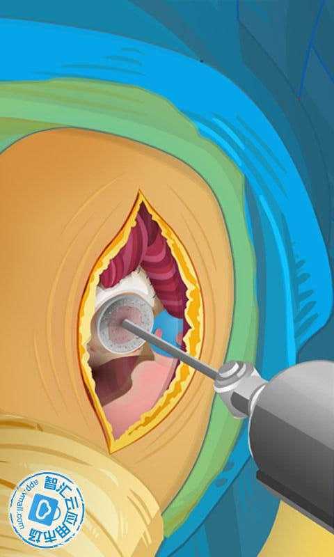 Virtual Hip Surgery截图3