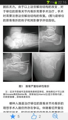 足踝外科电子杂志截图2