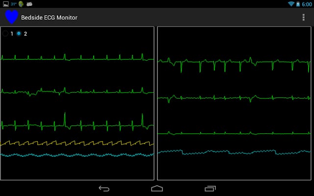 Bedside ECG Monitor截图2