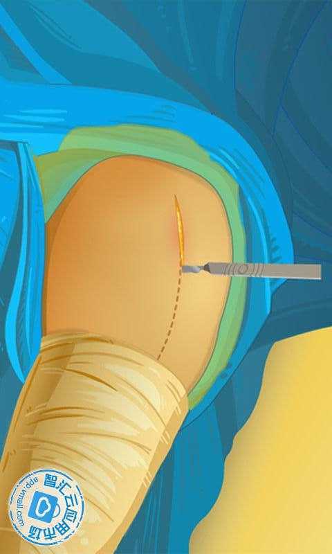 Virtual Hip Surgery截图5