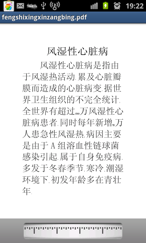 风湿性心脏病治疗治疗截图2