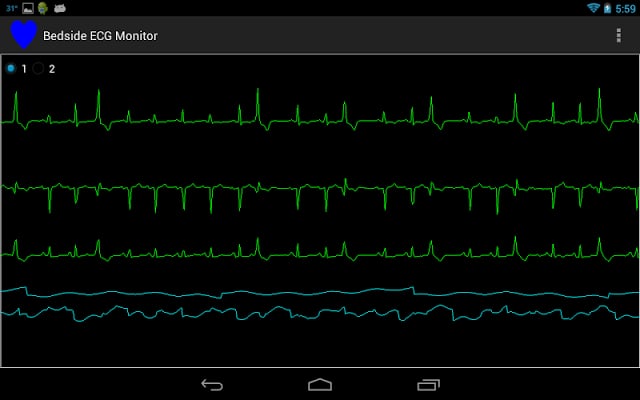 Bedside ECG Monitor截图5