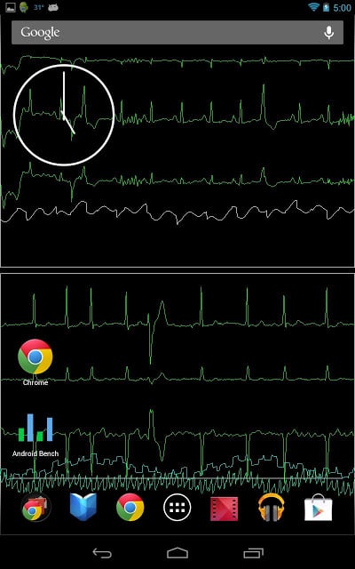 Bedside ECG Monitor截图6