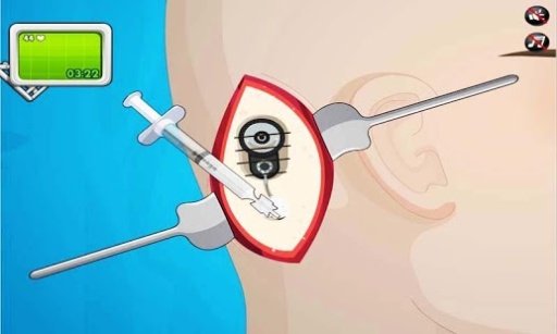 Ear Surgery截图5