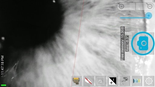 Slit Lamp Pro - Ophthalmic CAM截图3