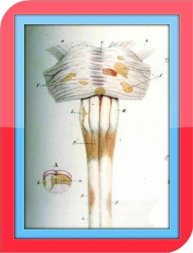 Multiple Sclerosis Symptoms截图1