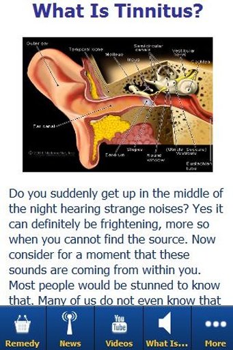 What Is Tinnitus Guide截图10