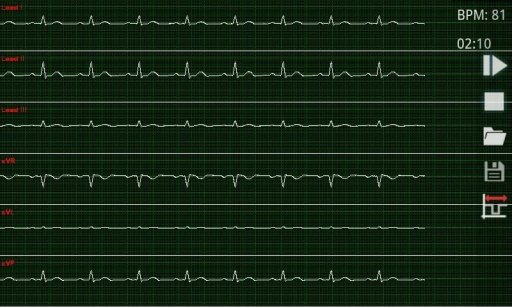 心电图心率监视器截图2