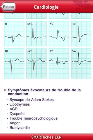 SMARTfiches Cardiologie FREE截图3