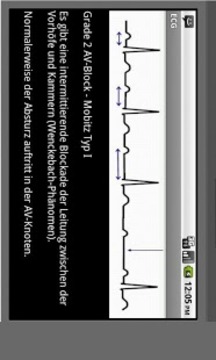 Elektrokardiogramm EKG Typen截图