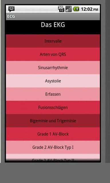 Elektrokardiogramm EKG Typen截图4