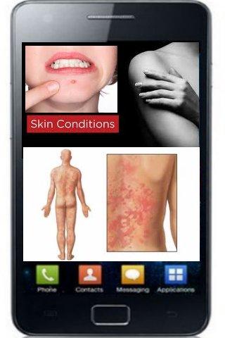 Skin Conditions截图2