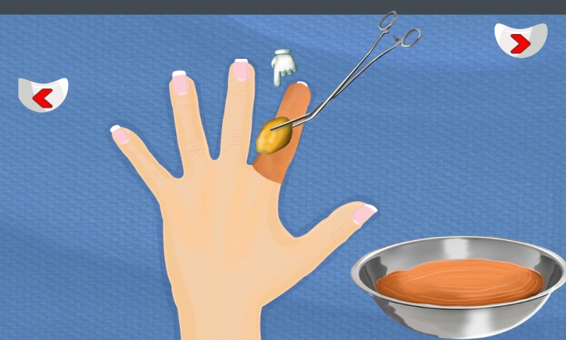 Finger Surgery Doctor截图5