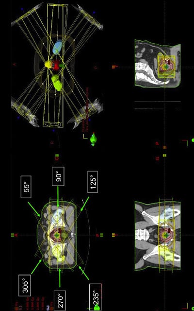 Siriade Digestif et Urologie截图2