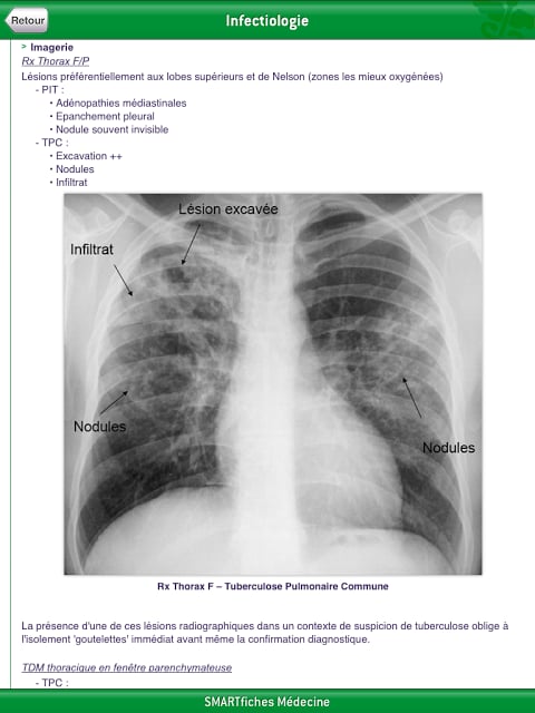 SMARTfiches Infectiologie Free截图5