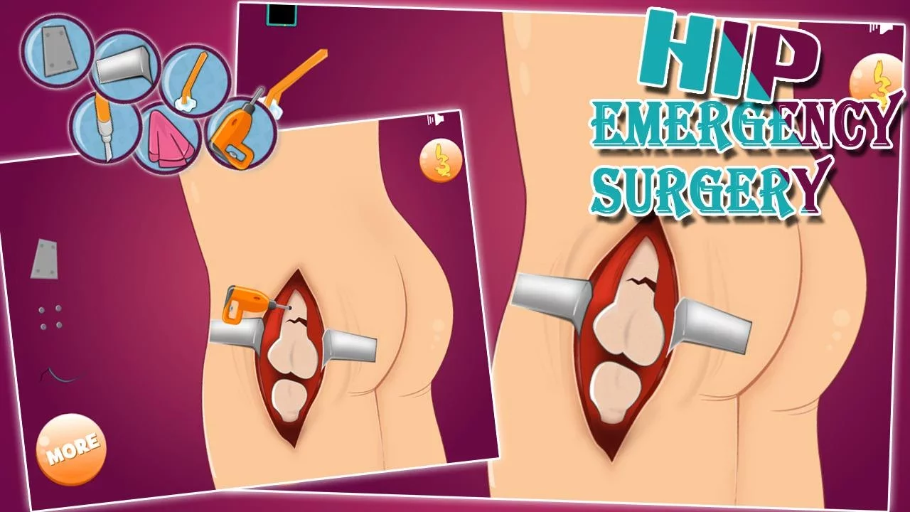 Virtual hip emergency surgery截图3