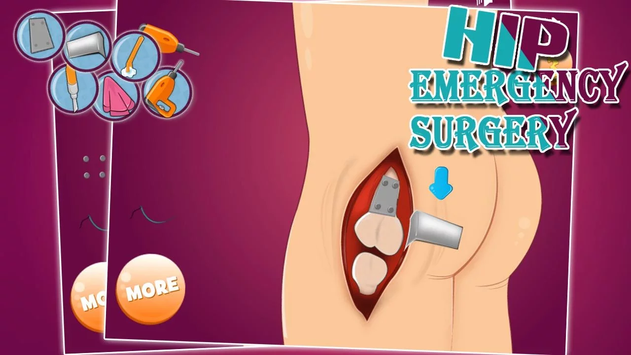 Virtual hip emergency surgery截图5