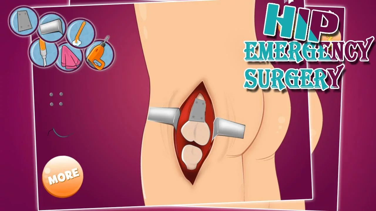 Virtual hip emergency surgery截图4