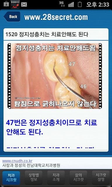 치과시크릿截图5