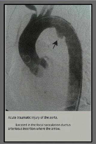 Radiology radiographs exam截图5