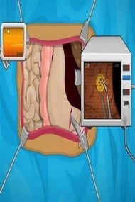 胃手术 Stomach Surgery截图4