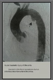 Radiology radiographs exam截图1