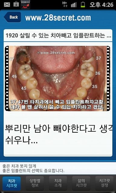 치과시크릿截图3