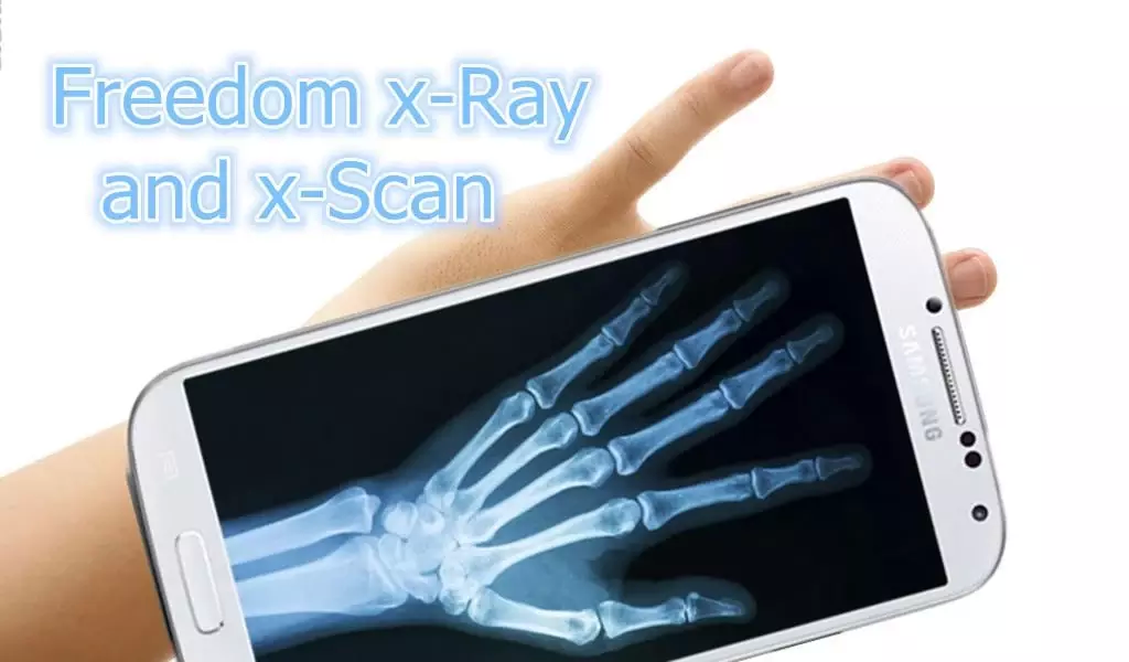 X-Ray Scanner for free截图11