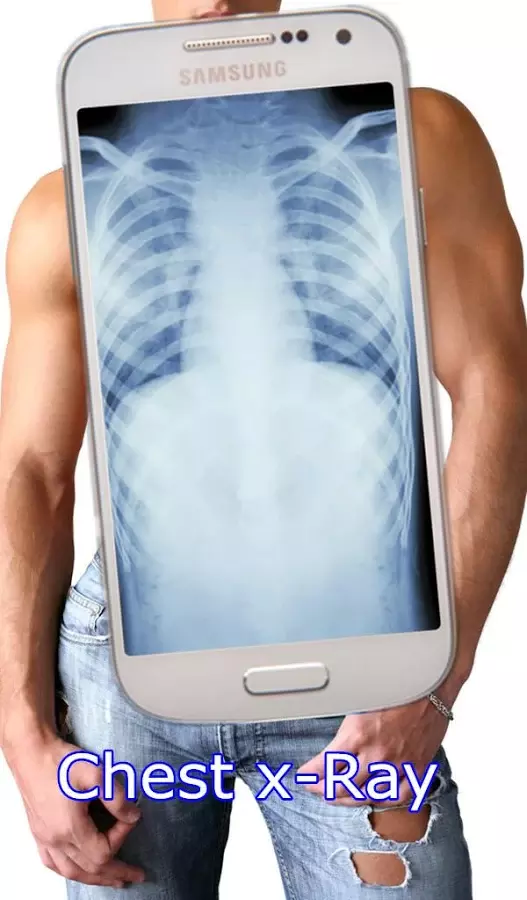 X-Ray Scanner for free截图8