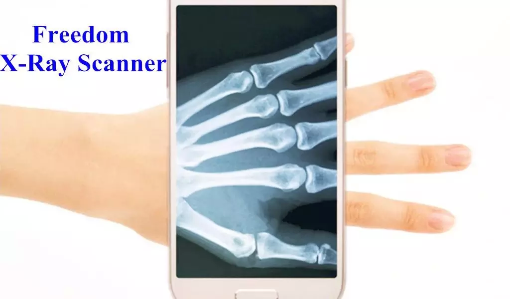 X-Ray Scanner for free截图2