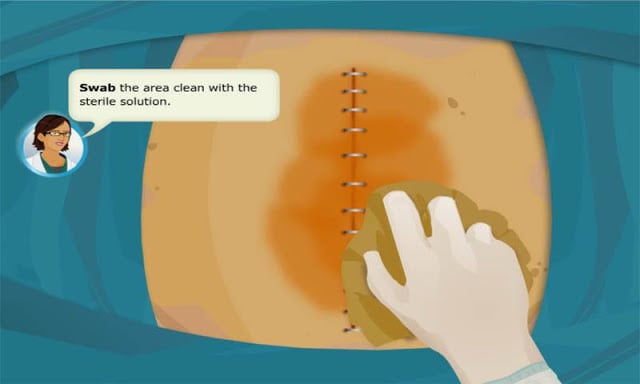 Virtual Doctor-Stomach Surgery截图4