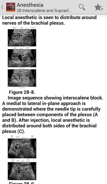 Atlas Ultrasound Anesthesia TR截图8