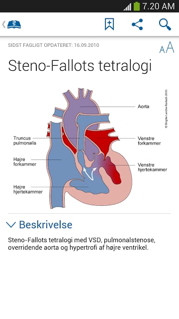 L&aelig;geh&aring;ndbogen截图4