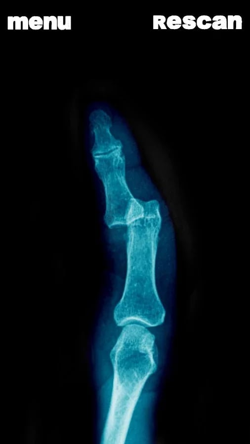 模拟器X射线手指笑话截图7