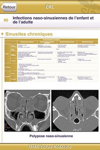 SMARTfiches ORL Free截图2