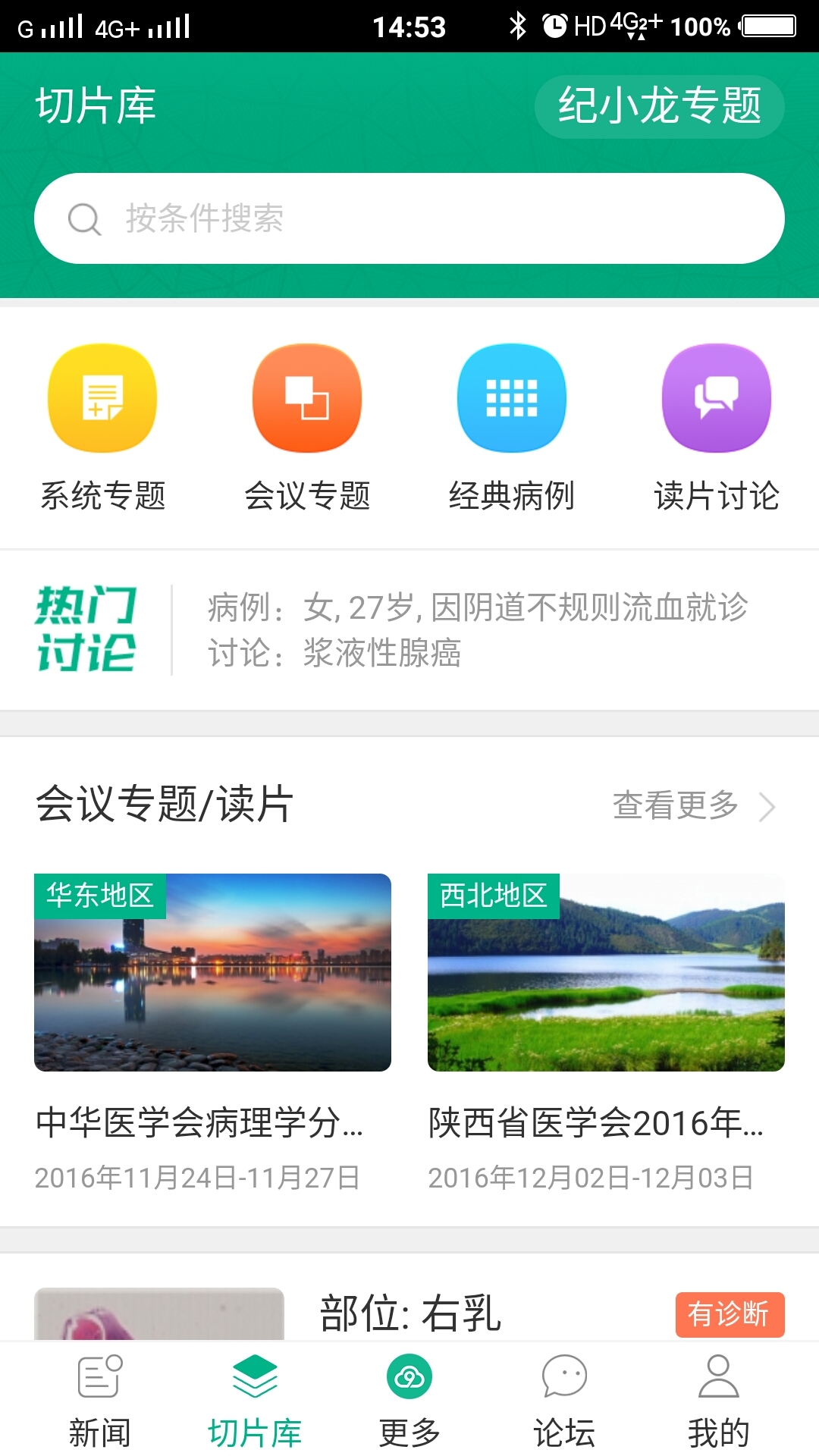 91360病理截图2