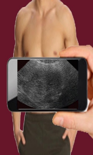 Ultrasound Scanner (Prank)截图2