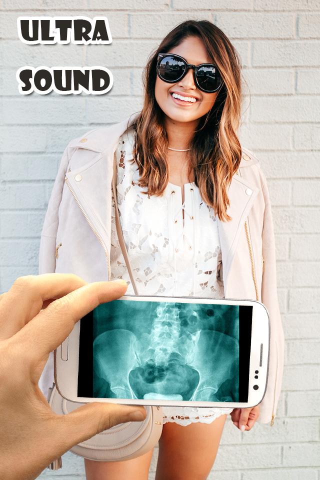 Ultra Sound Xray Scanner Prank截图2