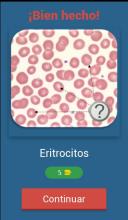 Quiz de Hematología截图2