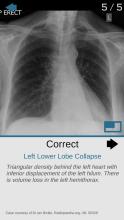 Plain Films - Radiology for Medical Students截图3