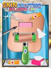 How to perform Skin Grafting Surgery截图2