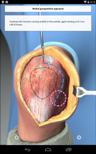 Touch Surgery截图10