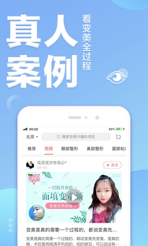 悦美微整形v6.8.4截图3