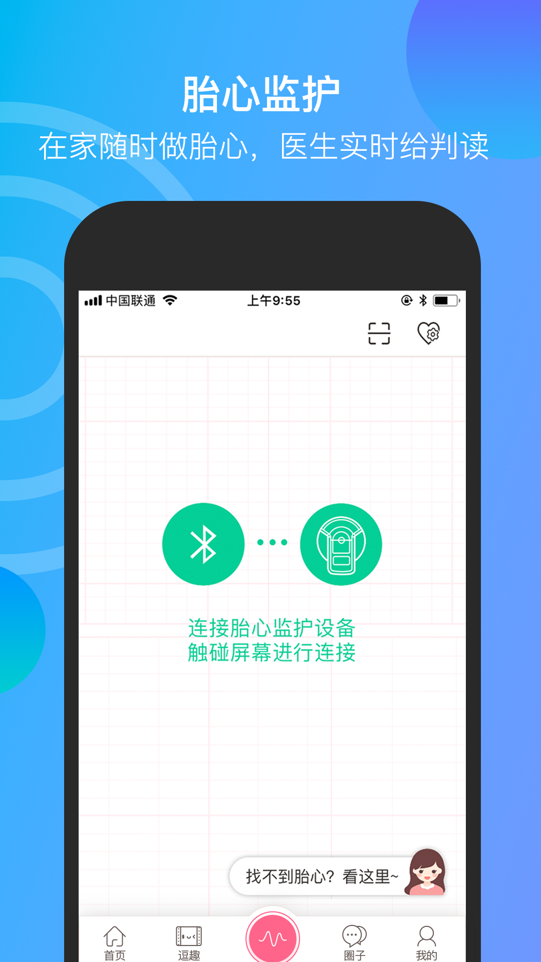 微胎心v2.5.2截图4