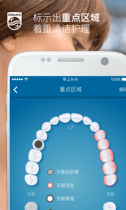 Sonicare截圖預覽