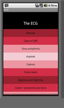 Electrocardiogram ECG Types截图