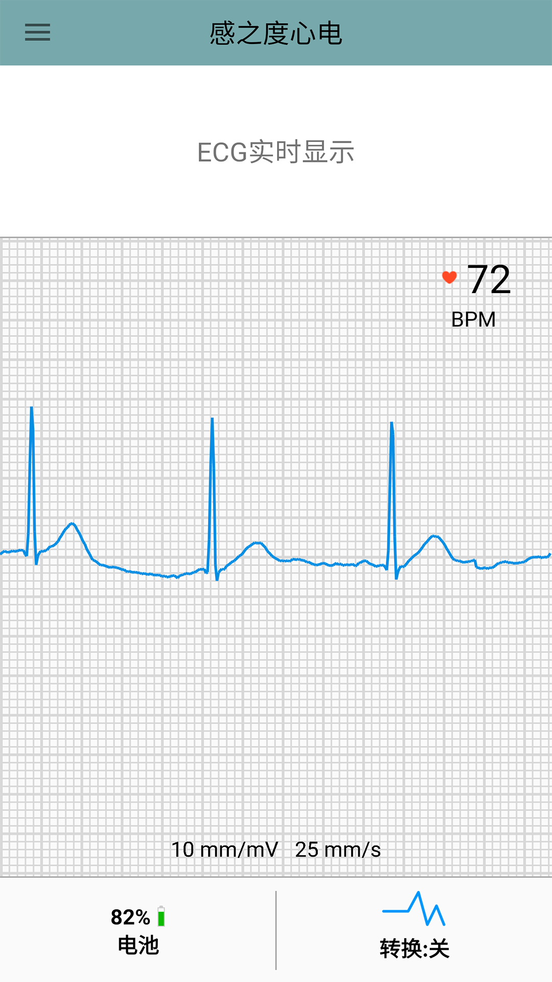 感之度心电截图1