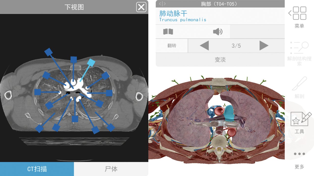 2020人体解剖学图谱 Mod截图1