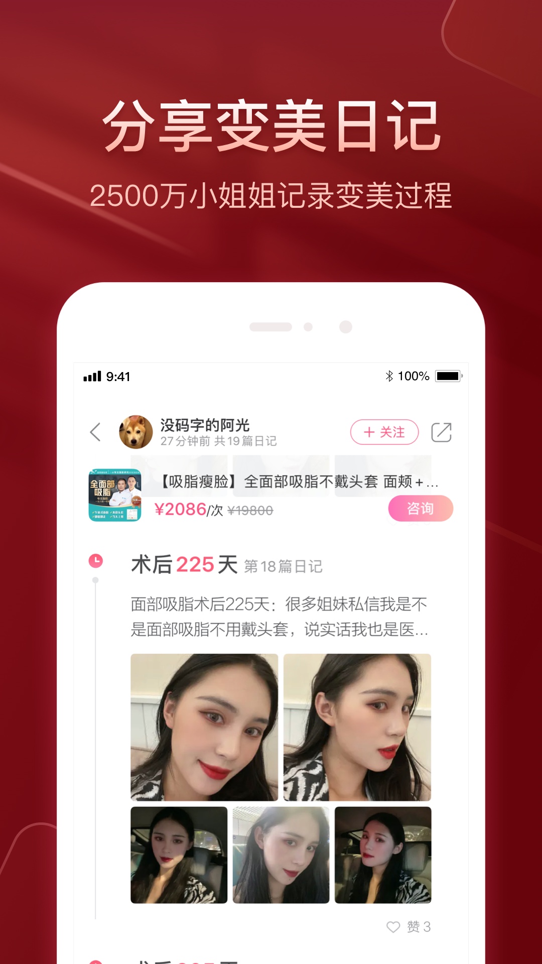 悦美微整形v7.6.2截图2